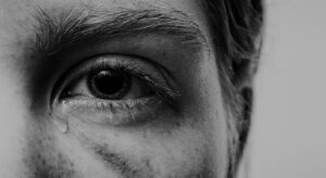 eye crying